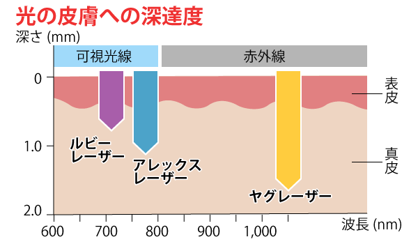 光の皮膚への深達度